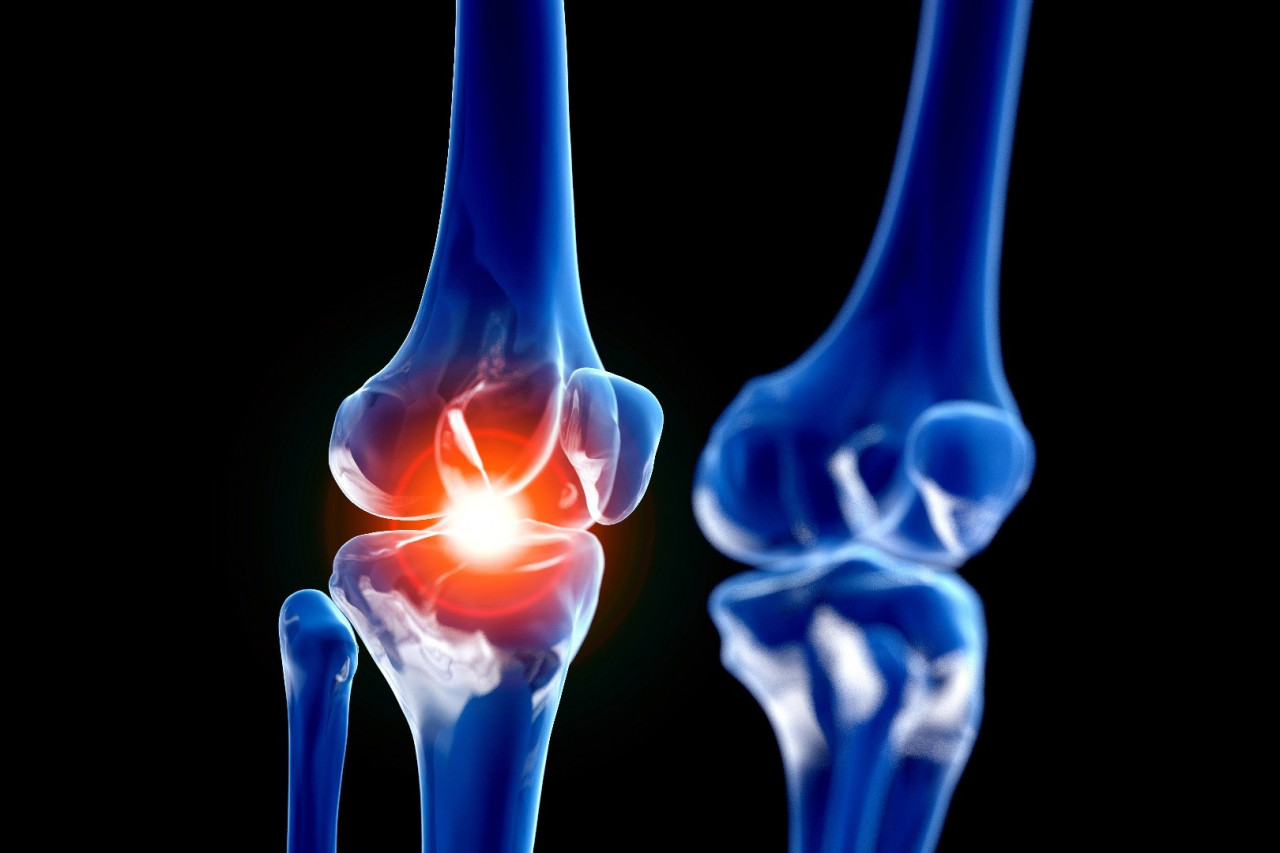 What’s New on the Bone and Joint Supplement Market